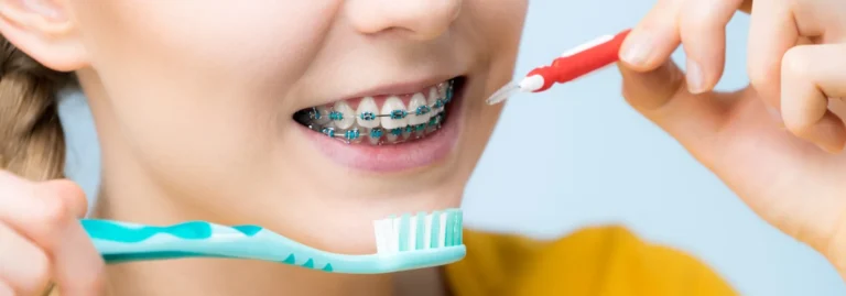 Read more about the article Mastering the Art of Brushing with Braces – Know The Right Way